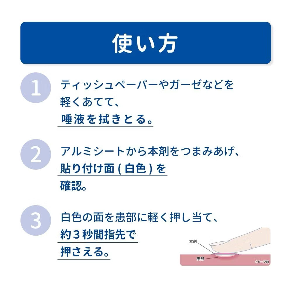 Japan Daiichi Sankyo Traful Ulcer Patch – Fast Healing Mouth Sore Patch